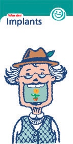 BDHF Leaflets Tell Me About Implants 100pk