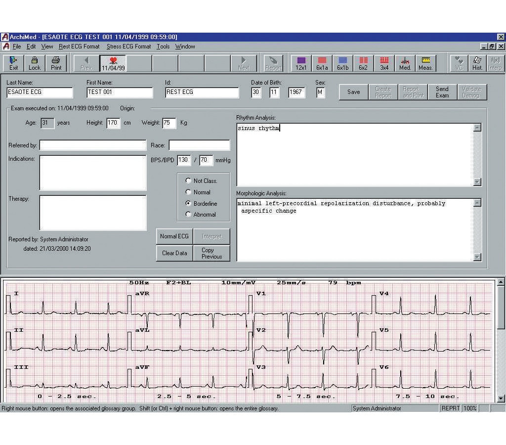 1080812_UK_Front_01_-Seca-582-Hard-ECG-Case-for-CT3000--CT8000i.jpg