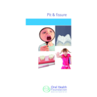 BDHF Leaflets Pit & Fissure Sealants 100pk