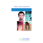 BDHF Leaflets Root Canal Treatment 100pk
