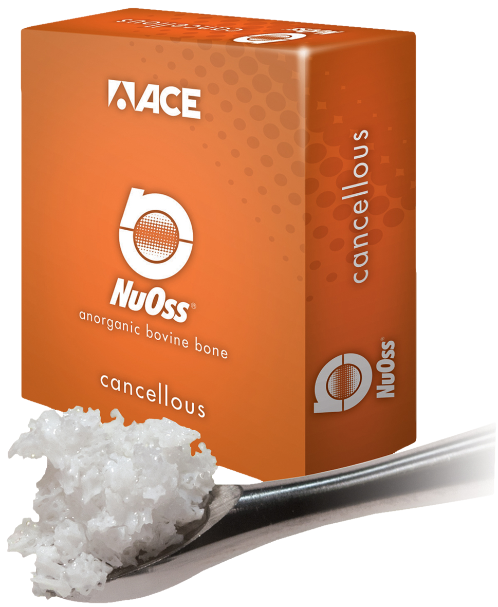 1091911_UK_Front_01_s_-NuOss-Cancellous-Granules-0251mm-1g.png