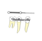 Power Closing Spring .010 x .030" 9mm