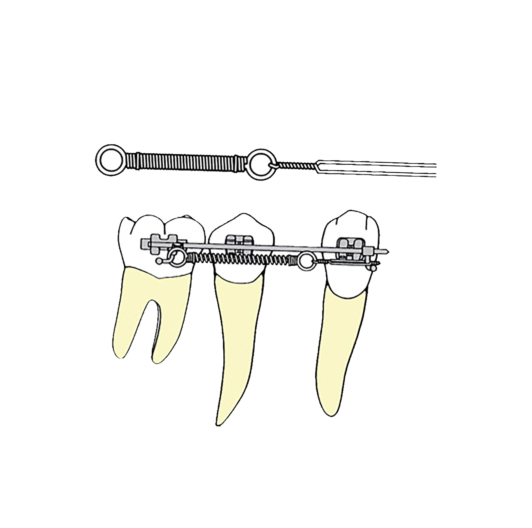 Power Closing Spring .010 x .030" 9mm