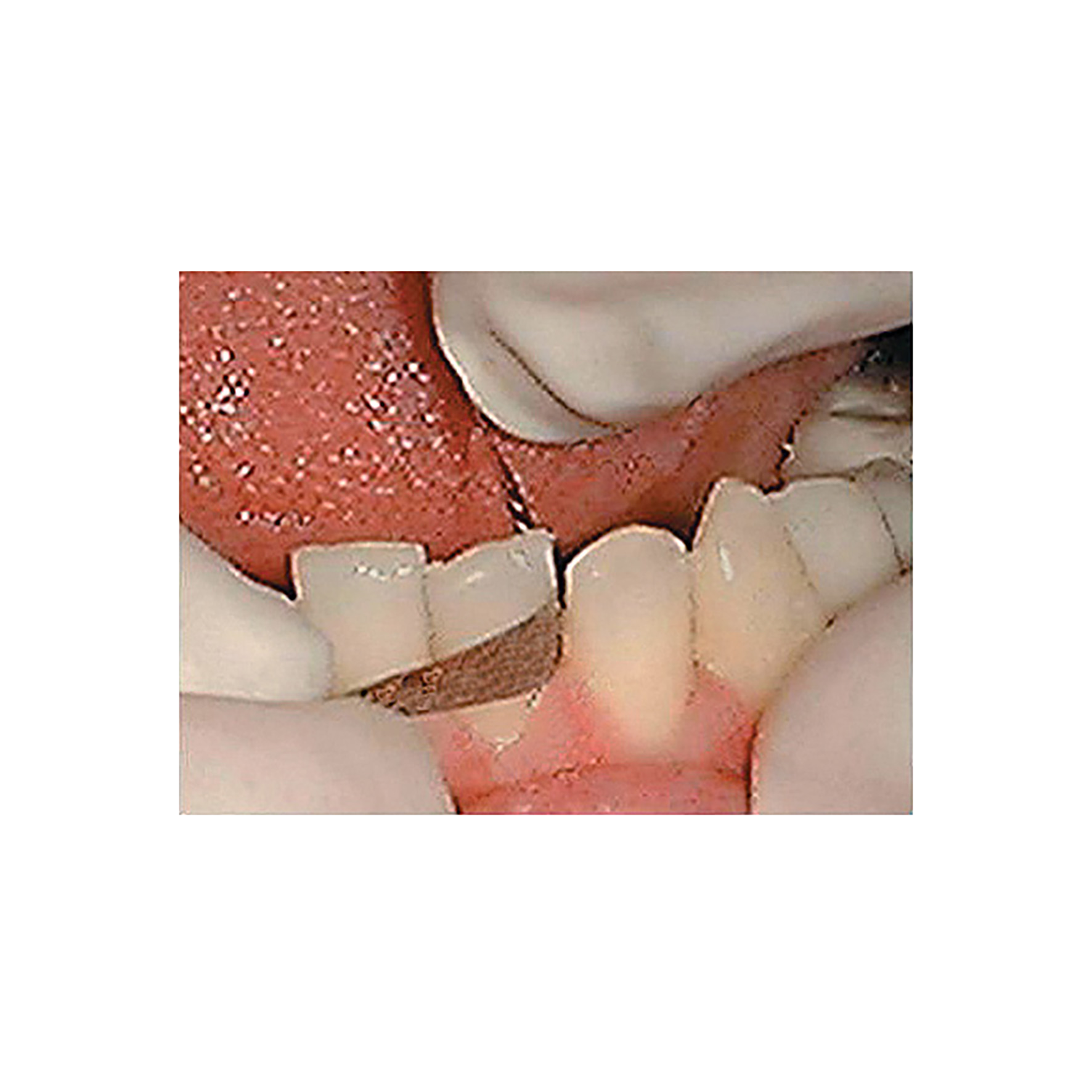 Diamond Interproximal Strip Double Sided Medium Brown 2.5mm 10pk