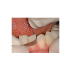 Diamond Interproximal Strip Double Sided Medium Brown 2.5mm 10pk