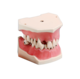 1105858_UK_Front_01_s_-Tooth-Set-With-Calculus-APB-ZC.png