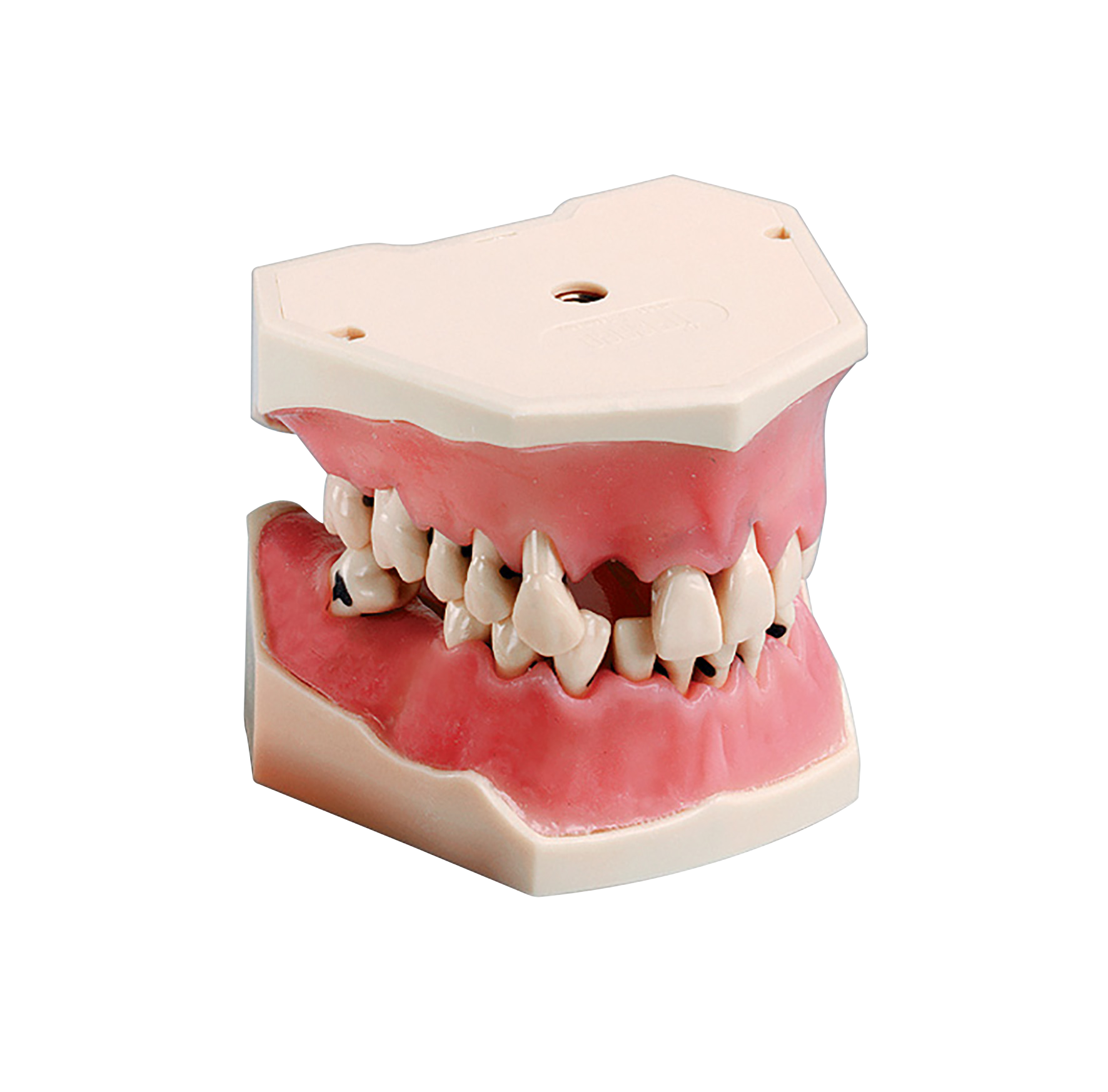 Tooth Set With Calculus A-PB ZC