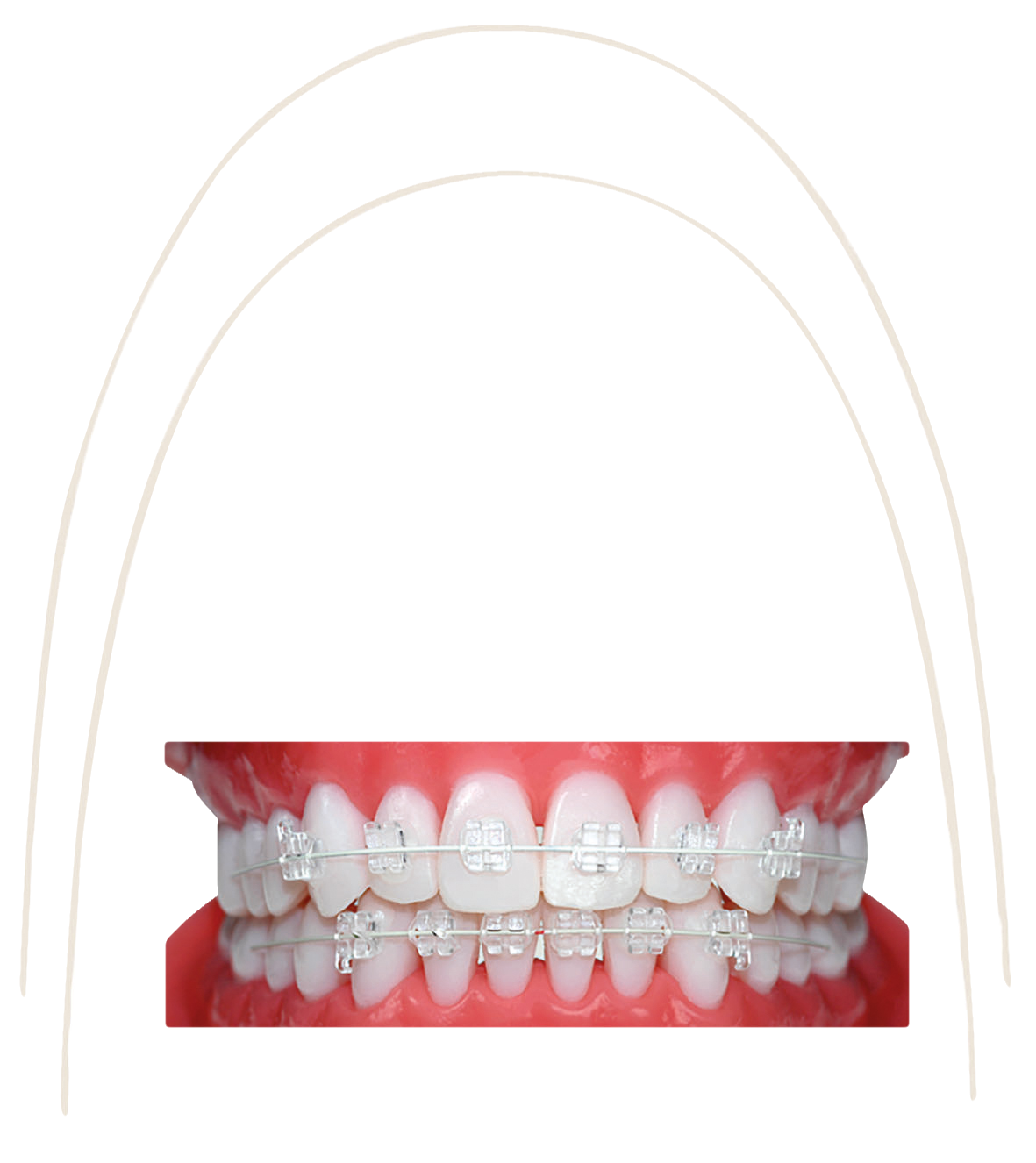 Euroform Cosmetic Archwire Stainless Steel Rectangle Upper .016 x .022 10pk